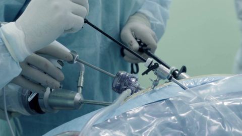 Treatments for laparoscopic hernioplasty eventration